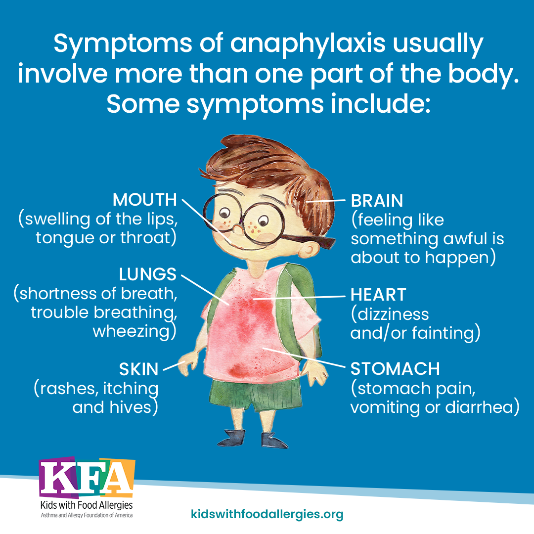 An illustration of a child with the text: Symptoms of anaphylaxis usually involve more than one part of the body. Some symptoms include mouth, lungs, skin, brain, heart, and stomach.
